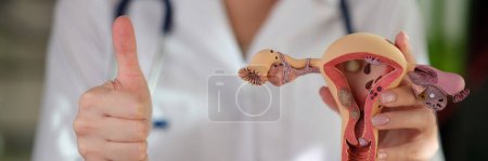 El médico sostiene el modelo anatómico del útero, de cerca. Tratamiento exitoso de los órganos reproductores femeninos