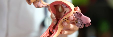 Model of female reproductive system in doctors hand close up. Concept of gynecology and womens healthcare.