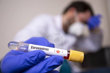 Photo for 2019-nCoV Coronavirus. Positive Blood Sample in Doctors Hand. Respiratory Syndrome. Coronavirus outbreaking - Royalty Free Image