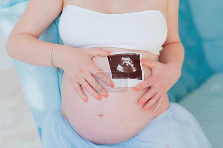 Foto de Primer plano de la mujer embarazada sosteniendo ultrasonido en su barriga - Imagen libre de derechos