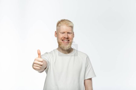 Téléchargez les photos : Homme barbu albinos en t-shirt souriant et montrant pouce vers le haut isolé sur blanc - en image libre de droit