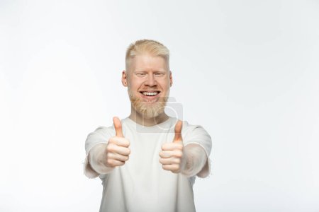 Téléchargez les photos : Homme barbu albinos en t-shirt souriant et montrant pouces vers le haut isolé sur blanc - en image libre de droit