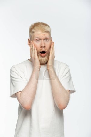 wstrząśnięty albinos człowiek w t-shirt dotykając twarzy i patrząc w aparat na białym 