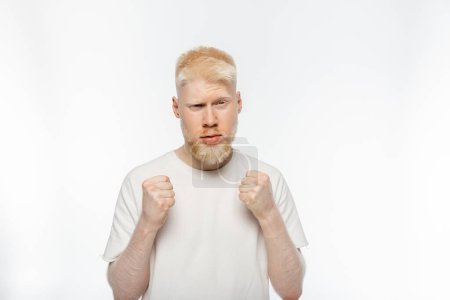 hombre albino barbudo en camiseta con puños cerrados sobre fondo blanco