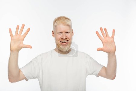 cheerful albino man in t-shirt waving hands isolated on white
