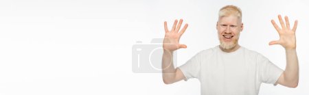fröhlicher Albino-Mann im T-Shirt wedelt mit den Händen auf weißem Banner