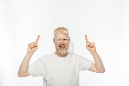 Photo pour Gai albinos homme en t-shirt pointant avec les doigts sur fond blanc - image libre de droit
