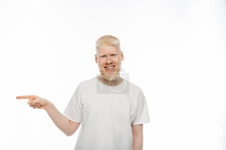 Photo pour Homme souriant albinos en t-shirt pointant du doigt sur fond blanc - image libre de droit