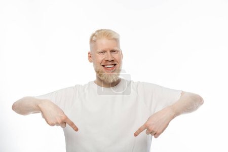 cheerful albino man in t-shirt pointing down with fingers on white background