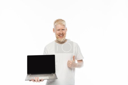 bearded albino man in t-shirt holding laptop with blank screen and showing thumb up isolated on white 