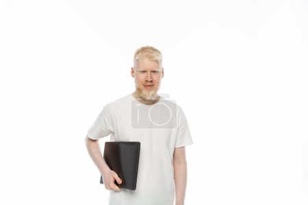 happy albino freelancer man in t-shirt holding laptop isolated on white