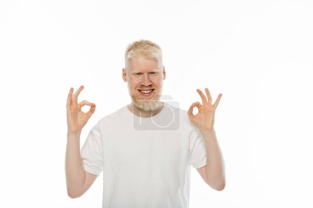 glücklicher Albino-Mann im T-Shirt zeigt ok Zeichen mit Händen isoliert auf weiß 