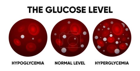 Glucose in the blood vessel. Normal levels, hyperglycemia, hypoglycemia. Normal, high and low blood sugar. Blood diagram. Vector illustration
