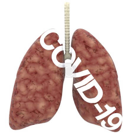 Foto de Escena de primeros planos de pulmones enfermos aislada en el fondo. Ideal para grandes publicaciones o impresión. representación 3d - ilustración - Imagen libre de derechos