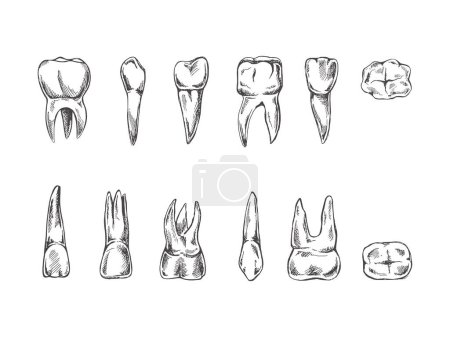Ilustración de Estomatología dibujada a mano. Tratamiento del dolor de muelas. Esbozo de dientes. Diferentes tipos de dientes humanos. Colmillos y molares de grabado. - Imagen libre de derechos