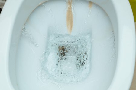 Photo for Dirty toilet bowl with limescale stain deposits. A toilet with traces of limescale, salt and stone deposits on the tiles - Royalty Free Image