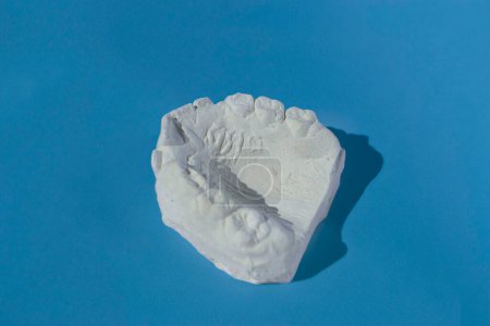 Téléchargez les photos : Moulage dentaire plâtre modèle plâtre moulé stomatologique mâchoires humaines laboratoire prothétique, des coups techniques. Photo de haute qualité - en image libre de droit