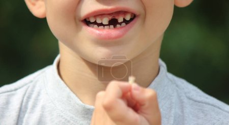 Photo for The child lost a tooth. Selective focus. Kid.Concept baby tooth - Royalty Free Image