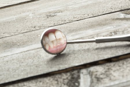 Téléchargez les photos : Miroir dentaire sur un fond en bois avec un reflet de la rangée de dents humaines - en image libre de droit