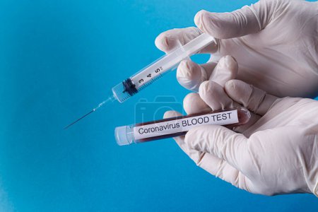 Foto de Jeringa y probeta con sangre relacionada con coronavirus aislada sobre fondo azul - Imagen libre de derechos