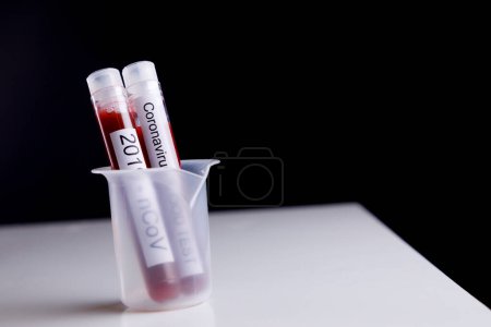Téléchargez les photos : Éprouvettes avec coronavirus test sanguin à l'intérieur, isolées sur fond noir - en image libre de droit