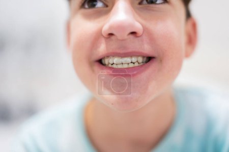 Foto de Teenager boy wear simulator orthodontic silicone invisible leveling braces for teeth.  Dental concept, orthodontics. - Imagen libre de derechos