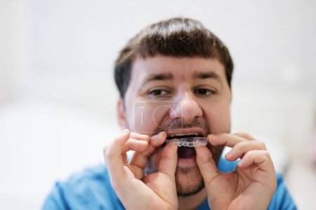 Foto de Mobile orthodontic appliance for dental correction. Man wearing orthodontic silicone trainer or invisible braces aligner. - Imagen libre de derechos