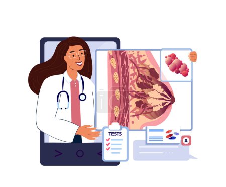 Illustration for Online App Consultation,Mammologist Doctor for Patient.Lacteal Gland,Cancer Swelling,Female Breast.Internet Treatment.Home Digital Medical Hospital Diagnostics for women.Flat Vector Illustration - Royalty Free Image