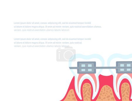 Illustration for Dentistry Stomatology poster,White Background.Vector illustration.Dental Hygiene Concept Clinic Healthy Clean Teeth,Dental implants,Orthodontic Anchor.Dentist Tools,Equipment.Place for your text - Royalty Free Image