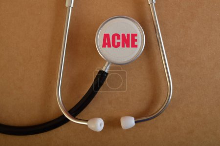 Photo for Stethoscope with text ACNE. Acne is a common skin condition that occurs when hair follicles become clogged with oil, dead skin cells, and bacteria. It typically presents as pimples, blackheads, whiteheads, or deeper, painful nodules or cysts on the f - Royalty Free Image