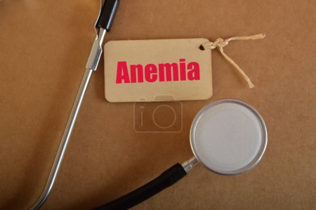 Foto de Estetoscopio con texto ANEMIA. La anemia es una afección caracterizada por una disminución en el número de glóbulos rojos o una disminución en la cantidad de hemoglobina en la sangre. - Imagen libre de derechos