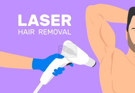 Illustration for Man armpit laser epilation hair removal doctor hand with epilator vector illustration - Royalty Free Image