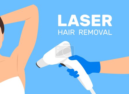 Illustration for Woman armpit laser epilation hair removal doctor hand with epilator vector illustration - Royalty Free Image