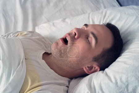 Porträt eines Mannes, der mit offenem Mund schläft. Das Problem des Schnarchens im Schlaf. Ein junger netter Kerl schläft am Tag oder am Morgen auf einem weißen Bett