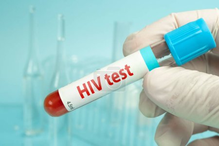 Prélèvement sanguin à la main pour le test du VIH sur fond de laboratoire bleu.