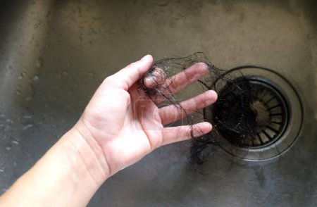 Hand zieht Haare aus der Spüle im Küchenabfluss. Weibliche Handfläche extrahiert Schock der Haare aus Siphon in der Spüle in der Küche. Wasserabfluss Loch mit Haarklumpen verstopft. Aus nächster Nähe. Reinigung