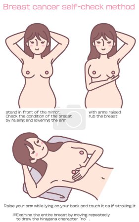 Ilustración de Breast cancer self-check method - Imagen libre de derechos