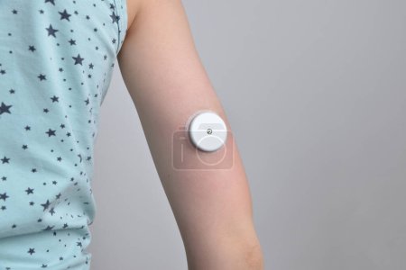 Mano de niño con sensor blanco para monitorización continua de glucosa. Concepto de salud, manejo de la diabetes, tecnología médica y soluciones de monitoreo