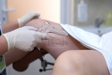 Photo for The gynecologist takes a vaginal swab for bacterial examination. Gynecological chair - Royalty Free Image