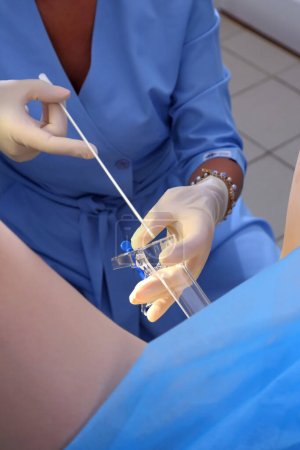 Pipelle Biopsie-Verfahren. Der Gynäkologe führt eine Pipellenbiopsie durch. Frauenarztstuhl. Eine Frau beim Gynäkologen zur Untersuchung.