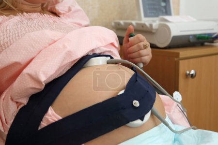 Foto de Un dispositivo de monitoreo cardíaco fetal para mujeres embarazadas. Control cardíaco del embarazo. Prueba de STV. Monitor cardíaco fetal en mujeres embarazadas. Cardiografía fetal. - Imagen libre de derechos