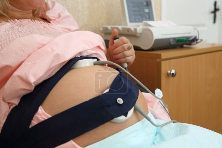 Un dispositivo de monitoreo cardíaco fetal para mujeres embarazadas. Control cardíaco del embarazo. Prueba de STV. Monitor cardíaco fetal en mujeres embarazadas. Cardiografía fetal.