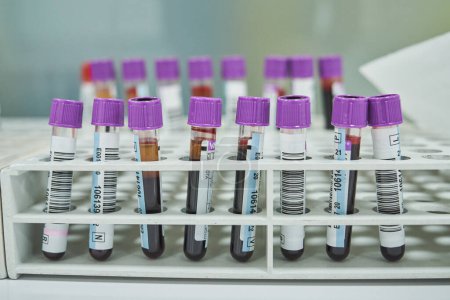 Foto de Conjunto de tubos de ensayo con sangre de color rojo oscuro de pacientes colocados sobre la mesa en un laboratorio moderno - Imagen libre de derechos