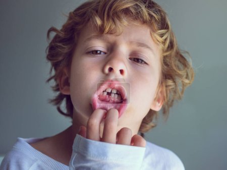 From below of adorable kid with curly blond hair and brown eyes demonstrating open mouth with one lost milk tooth while touching lip and looking at camera