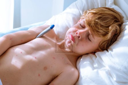 Foto de Alto ángulo de triste niño enfermo con erupción de varicela en el torso desnudo cerrando los ojos y haciendo pucheros labios mientras descansa en la cama y midiendo la temperatura durante el día - Imagen libre de derechos