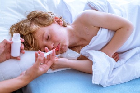 Photo for High angle of naughty kid with varicella blisters pouting lips and closing eyes while lying on bed and taking remedy from crop mother at home - Royalty Free Image