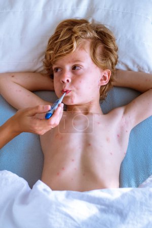 Photo for Top view of crop mom using taking digital thermometer from mouth of sick child with chickenpox lying on bed and holding hands behind head - Royalty Free Image