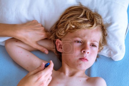 Top view of crop parent putting digital thermometer in armpit of unhappy boy with chickenpox blister looking away in daytime on bed at home 