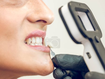 Téléchargez les photos : Vue latérale d'un stomatologue méconnaissable sans visage avec loupe et implant dans les mains vérifiant la teinte des dents d'un patient anonyme - en image libre de droit