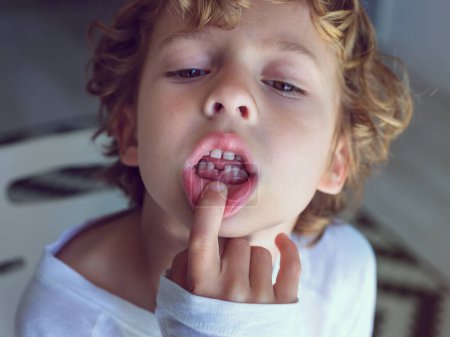 Foto de Lindo niño con cabello rubio rizado y ojos marrones demostrando boca con diente de leche perdido al tocar el labio y mirando hacia abajo - Imagen libre de derechos